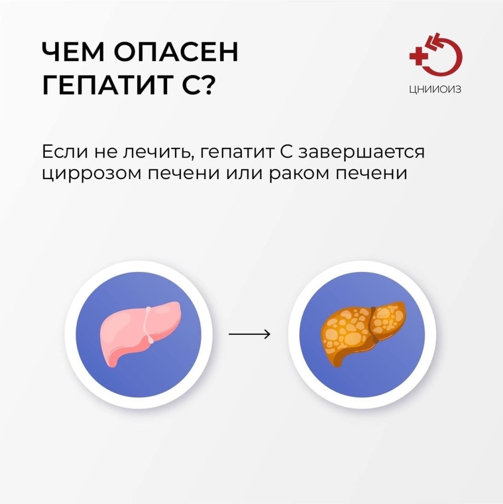 Гепатит С