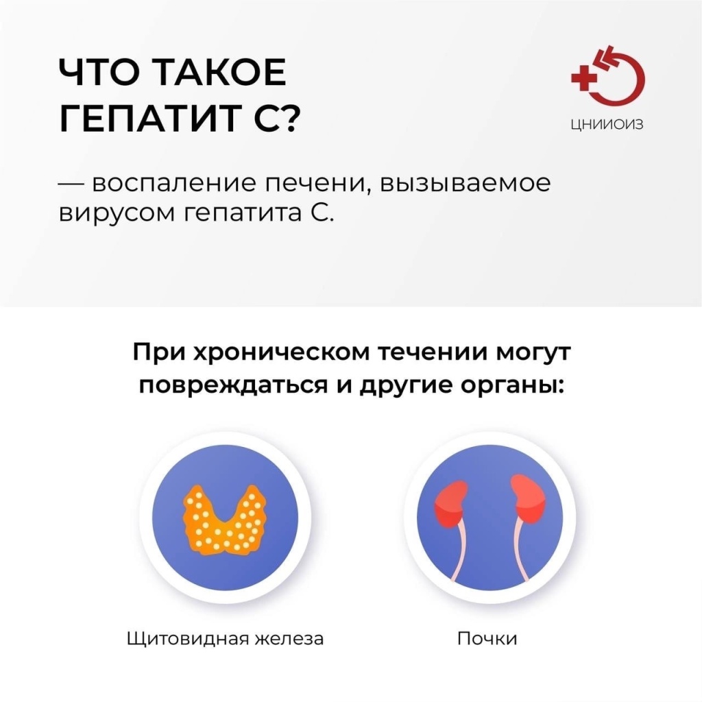 Гепатит С